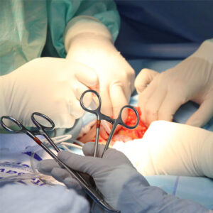 Surgical Instruments